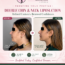 Double Chin Liposuction: Procedure, Benefits, Recovery and Results